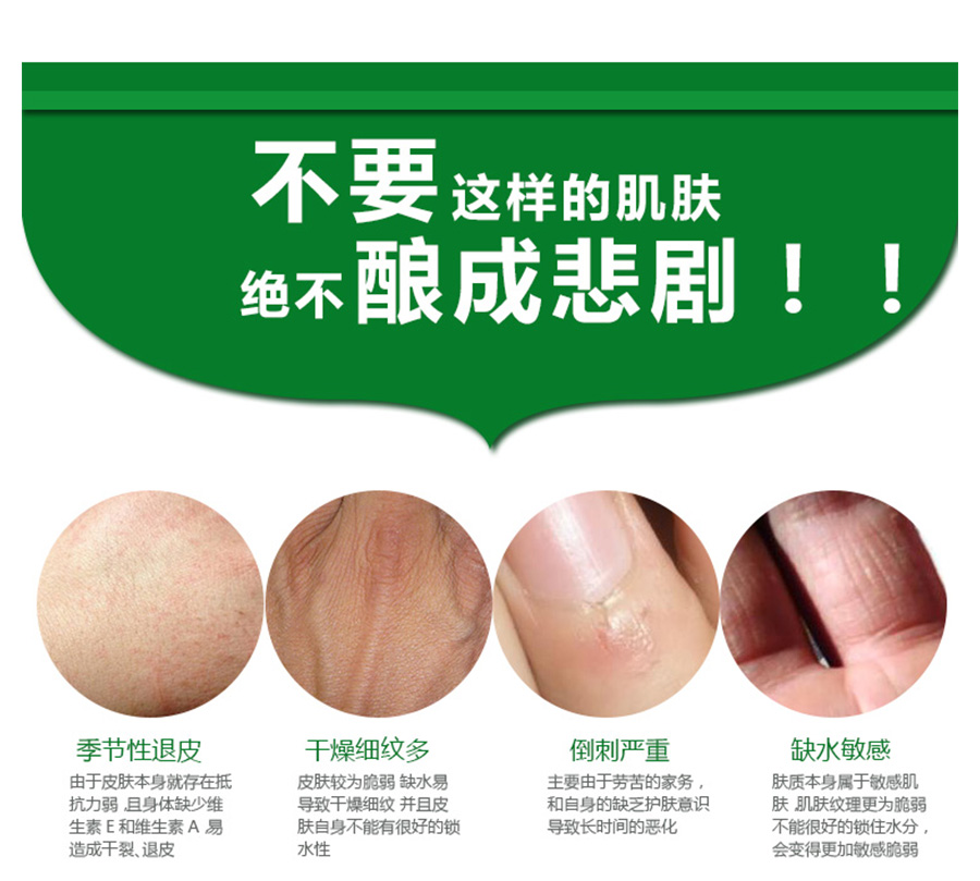 Glysomed 德国佳莉敏洋甘菊滋润保湿经典护手霜无香型 海外本土原版