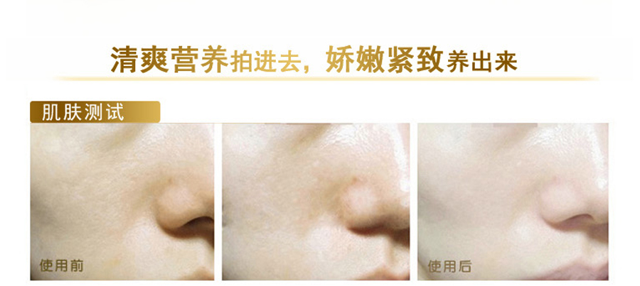 Royal Nectar ������Royal Nectar�ʼҷ䶾��˪ ���Ȿ��ԭ��